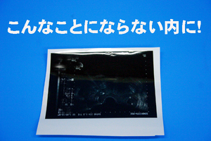 Echo photo It will disappear if you put it in the album. It is a photo print and saved safely ◆ 200 yen per sheet ◆ Carefully repair the deteriorated photo ★★